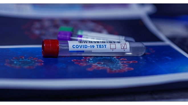 Кабмин разрешил получать результаты тестов на коронавирус через "Госуслуги"