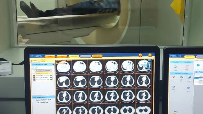 Один из компьютерных томографов в Покровской больнице снова начал работать