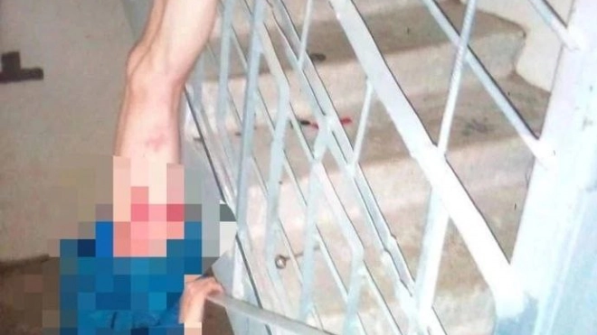 Наркоман без штанов повис на перилах лестницы в Петербурге