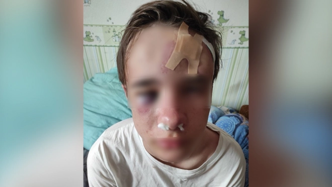 В Петербурге двое незнакомцев избили 16-летнего подростка из-за сережки в ухе