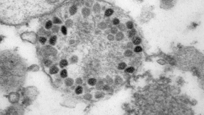 Британские исследователи оценили риски повторного заражения при омикрон-штамме коронавируса
