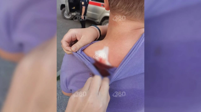 Подростка в Новокузнецке ранили из пневмата