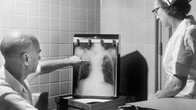В Петербурге наблюдается исторический минимум заболеваемости туберкулезом за всю историю наблюдения