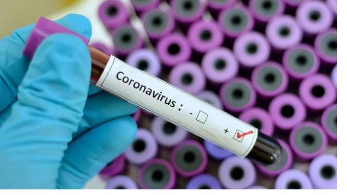 В России выявили 16,5 тысячи новых случаев заражения коронавирусом