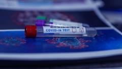 В России создана новая тестовая система для определения антител к COVID-19