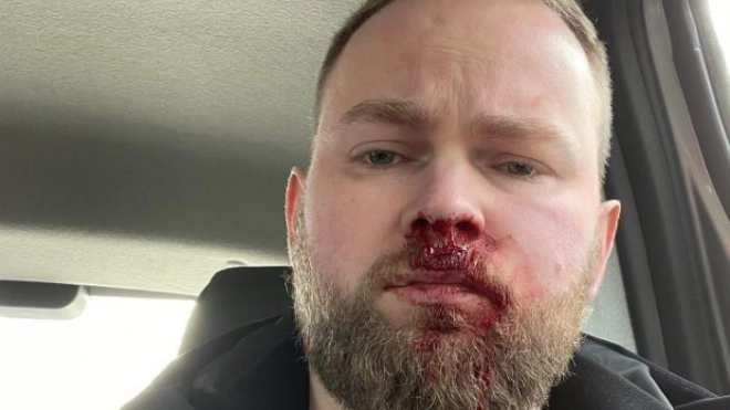 Петербургского блогера Илью Бронского избили после его рассказа о жизни с ВИЧ