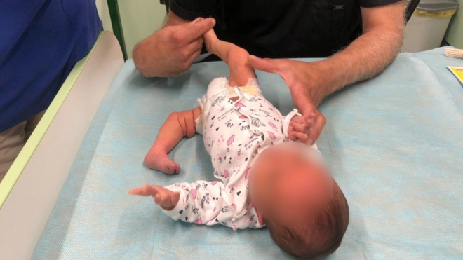 Петербургские медики помогли девочке с врожденным вывихом коленного сустава