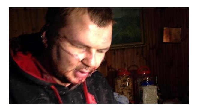 СМИ: похищенного лидера Автомайдана зверски пытали: распяли, отрезали ухо