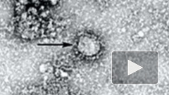 Китай опубликовал снимок нового коронавируса 2019-nCoV
