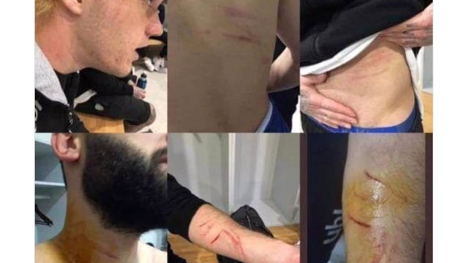 Турция: Футболист пронес на поле лезвие и порезал соперников