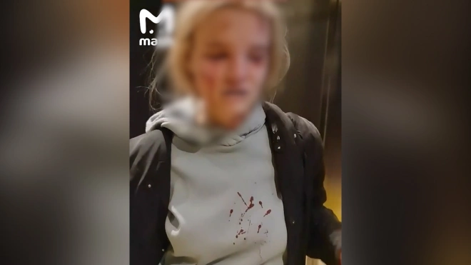В Подмосковье проверят видео с пострадавшей в лифте девушкой