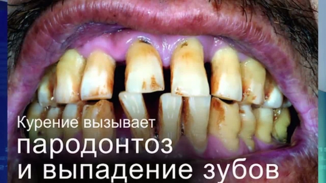 Страшные картинки на пачках сигарет появятся в России с июля 2012 года