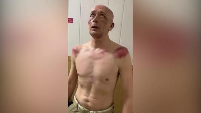 В Пензе адвокат снял на видео подзащитного, которого, предположительно, избили в полиции