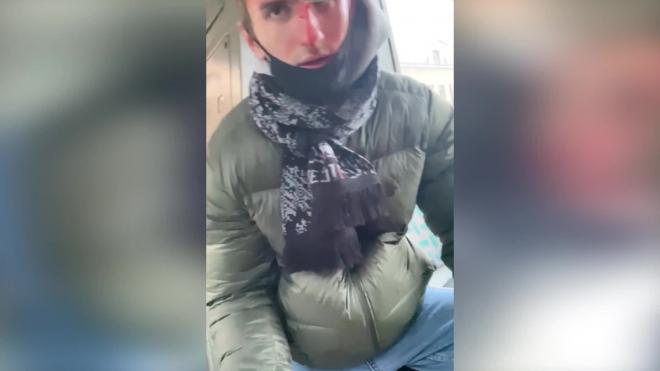 Задержанный рассек голову во время протестной акции в Петербурге