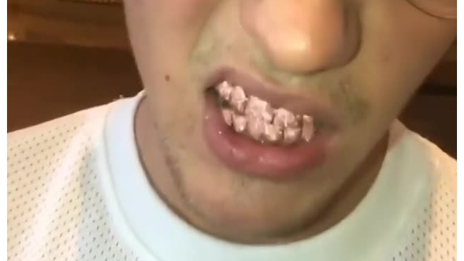 Видео: Джастин Бибер украсил зубы бриллиантами и сапфирами