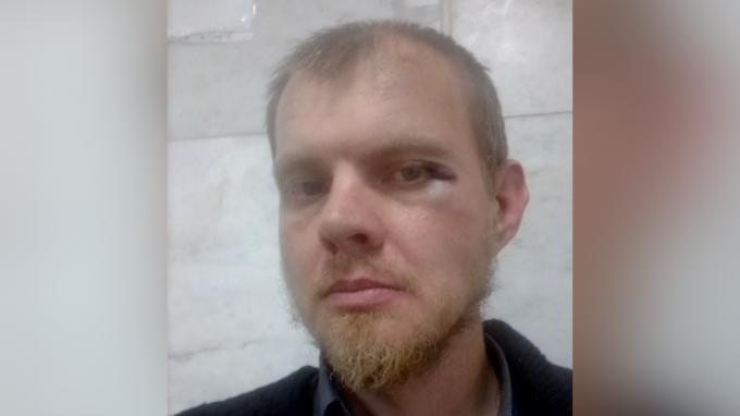В Челябинске неизвестные напали на координатора штаба Навального