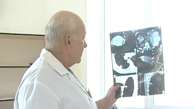 Главный онколог России сообщил о росте заболеваемости раком