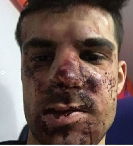 Футболист "Зенита" рассказал подробности своего избиения